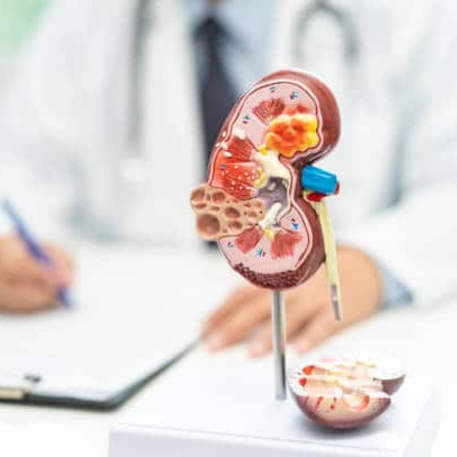 istockphoto-1777620173-612×612 Kidney disease, Chronic kidney disease ckd, Doctor with human model to study and treat in hospital.